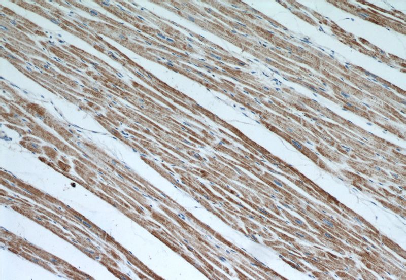Immunohistochemical of paraffin-embedded human heart using Catalog No:112692(MMADHC antibody) at dilution of 1:50 (under 10x lens)