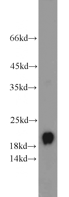 human placenta tissue were subjected to SDS PAGE followed by western blot with Catalog No:110622(FTL antibody) at dilution of 1:1000