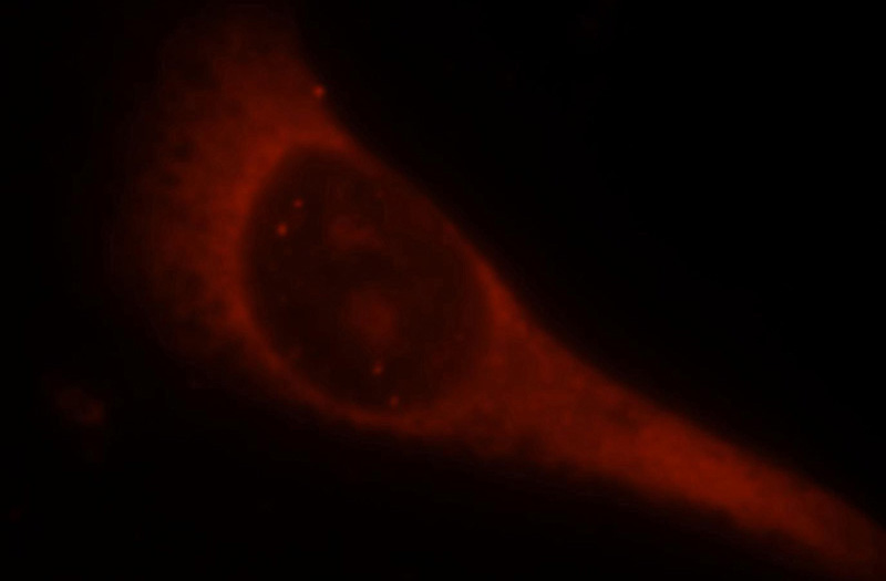 Immunofluorescent analysis of A375 cells, using LMOD1 antibody Catalog No:112284 at 1:25 dilution and Rhodamine-labeled goat anti-rabbit IgG (red).