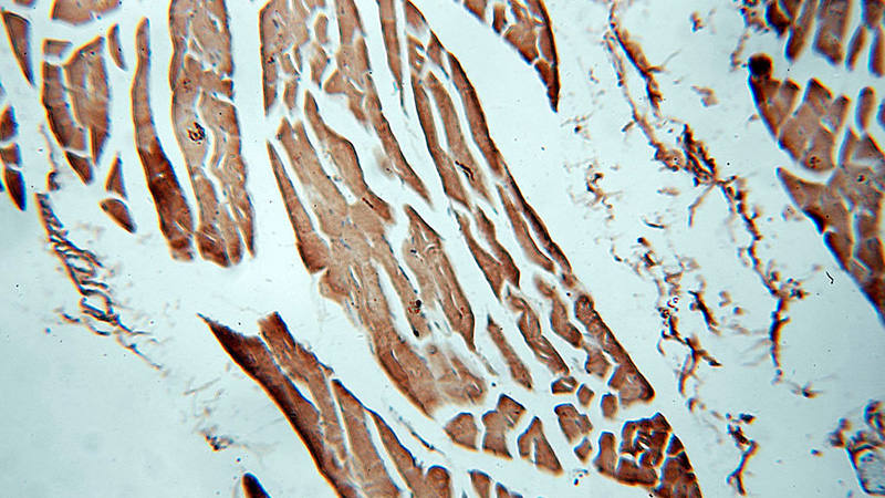 Immunohistochemical of paraffin-embedded human skeletal muscle using Catalog No:109542(CKM-Specific antibody) at dilution of 1:100 (under 10x lens)