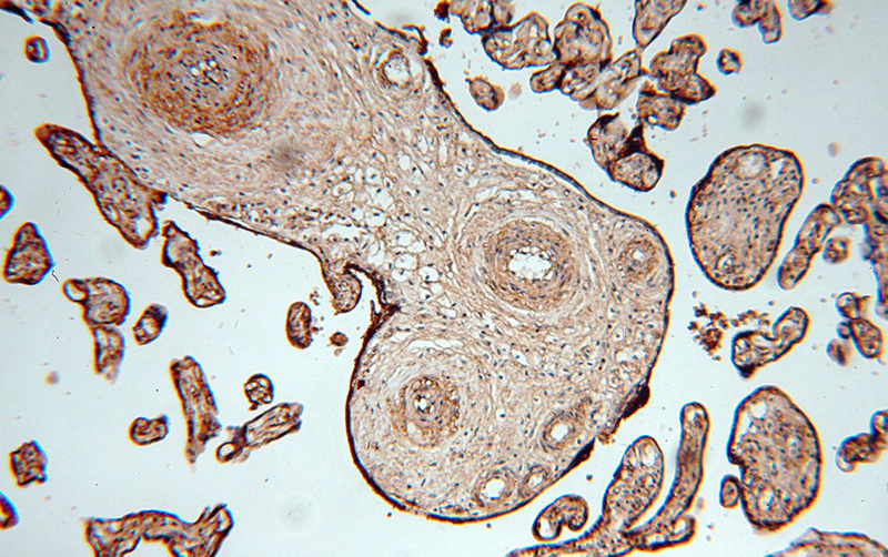 Immunohistochemical of paraffin-embedded human placenta using Catalog No:111262(HAUS4 antibody) at dilution of 1:100 (under 10x lens)