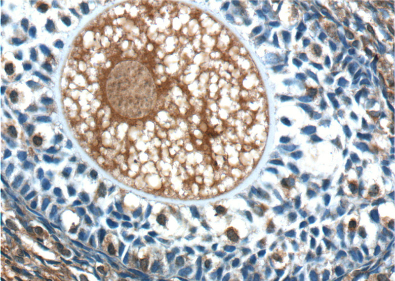 Immunohistochemistry of paraffin-embedded human ovary tissue slide using Catalog No:108083(ANKRD6 Antibody) at dilution of 1:50 (under 40x lens)