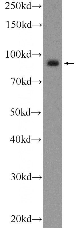 mouse brain tissue were subjected to SDS PAGE followed by western blot with Catalog No:111787(KPNB1 Antibody) at dilution of 1:600