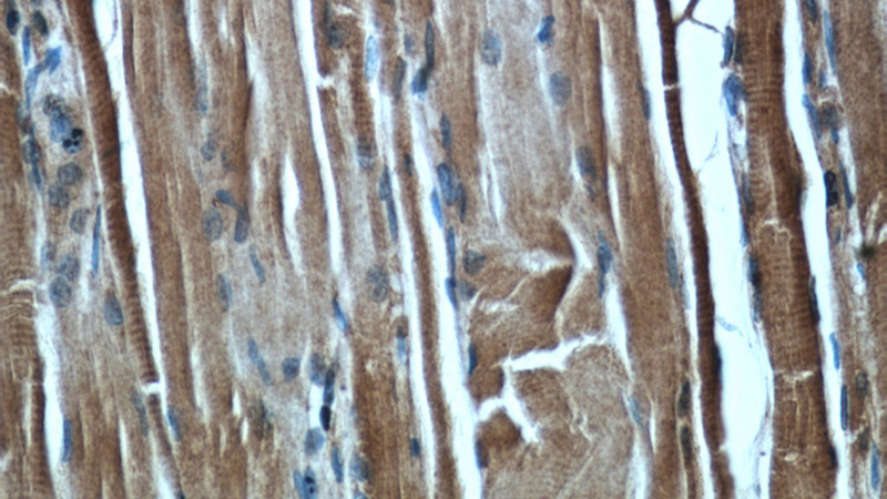 Immunohistochemical of paraffin-embedded human skeletal muscle using Catalog No:113860(PK-M1-specific antibody) at dilution of 1:100 (under 40x lens)