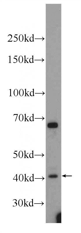 MCF-7 cells were subjected to SDS PAGE followed by western blot with Catalog No:116193(TMEM59 Antibody) at dilution of 1:300