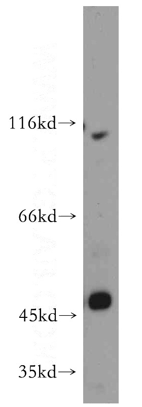 mouse lung tissue were subjected to SDS PAGE followed by western blot with Catalog No:117062(SLC39A8 antibody) at dilution of 1:800