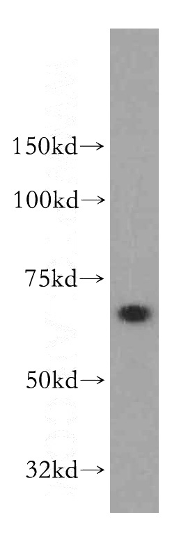 human kidney tissue were subjected to SDS PAGE followed by western blot with Catalog No:115041(SACM1L antibody) at dilution of 1:1000