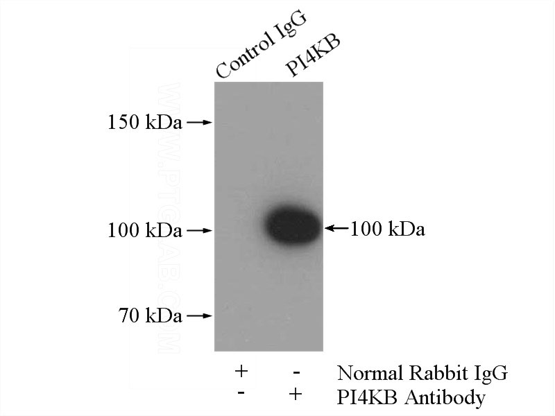 IP Result of anti-PI4KB (IP:Catalog No:113879, 4ug; Detection:Catalog No:113879 1:300) with K-562 cells lysate 3600ug.