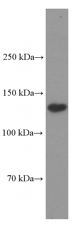 human spleen tissue were subjected to SDS PAGE followed by western blot with Catalog No:107040(CD11c/Integrin alpha X Antibody) at dilution of 1:1000