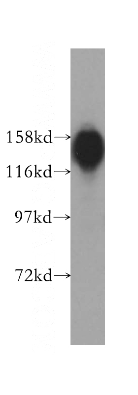 HL-60 cells were subjected to SDS PAGE followed by western blot with Catalog No:116840(WAPL; WAPAL antibody) at dilution of 1:300