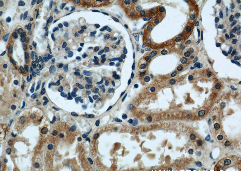 Immunohistochemical of paraffin-embedded human kidney using Catalog No:110420(EYA1 antibody) at dilution of 1:50 (under 40x lens)