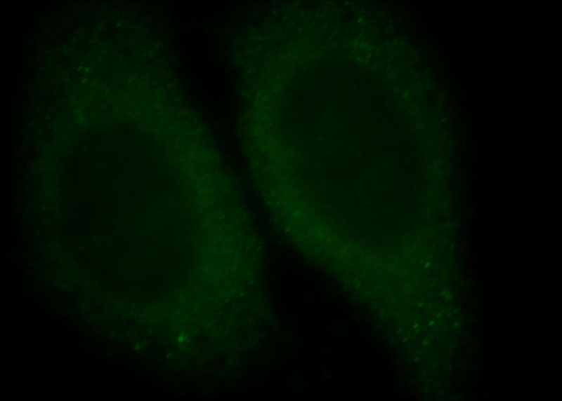 Immunofluorescent analysis of HepG2 cells, using WDR6 antibody Catalog No:116813 at 1:25 dilution and FITC- labeled goat anti-Rabbit IgG (green).