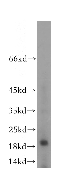 human testis tissue were subjected to SDS PAGE followed by western blot with Catalog No:115529(SPAG11A antibody) at dilution of 1:300