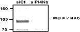 WB result of anti- PI4Kb (Catalog No:113879) with NIH-3T3 cells (RNAi).