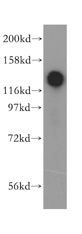 human brain tissue were subjected to SDS PAGE followed by western blot with Catalog No:115044(SAFB2 antibody) at dilution of 1:500