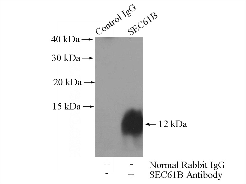 IP Result of anti-SEC61B (IP:Catalog No:115086, 4ug; Detection:Catalog No:115086 1:500) with HepG2 cells lysate 1800ug.