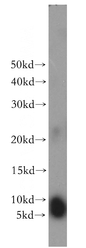 mouse brain tissue were subjected to SDS PAGE followed by western blot with Catalog No:115195(SERP1 antibody) at dilution of 1:500