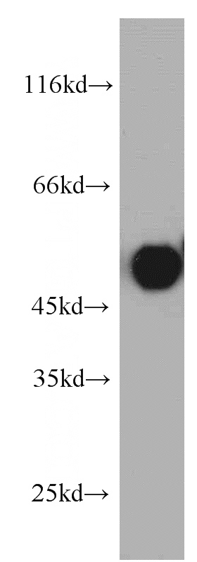 HeLa cells were subjected to SDS PAGE followed by western blot with Catalog No:116391(TRIP6 antibody) at dilution of 1:500