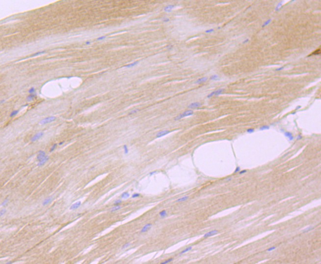 Fig4:; Immunohistochemical analysis of paraffin-embedded mouse skeletal muscle tissue using anti-Dysferlin antibody. The section was pre-treated using heat mediated antigen retrieval with Tris-EDTA buffer (pH 8.0-8.4) for 20 minutes.The tissues were blocked in 5% BSA for 30 minutes at room temperature, washed with ddH; 2; O and PBS, and then probed with the primary antibody ( 1/50) for 30 minutes at room temperature. The detection was performed using an HRP conjugated compact polymer system. DAB was used as the chromogen. Tissues were counterstained with hematoxylin and mounted with DPX.