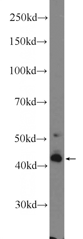 mouse lung tissue were subjected to SDS PAGE followed by western blot with Catalog No:107918(AGER Antibody) at dilution of 1:600