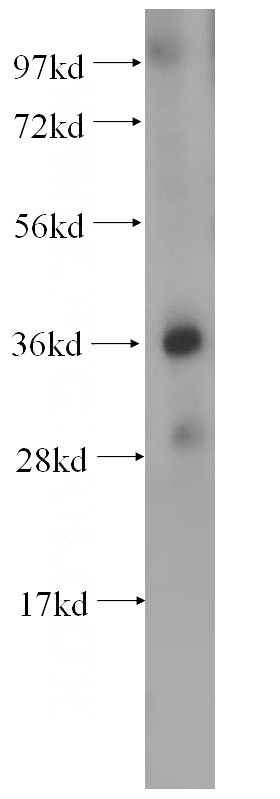 human heart tissue were subjected to SDS PAGE followed by western blot with Catalog No:113437(OSGEP antibody) at dilution of 1:500