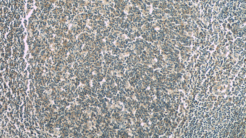 Immunohistochemistry of paraffin-embedded human tonsillitis tissue slide using Catalog No:107396(IL28A Antibody) at dilution of 1:50 (under 10x lens)