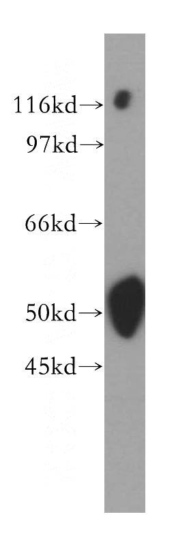 mouse skeletal muscle tissue were subjected to SDS PAGE followed by western blot with Catalog No:117246(BRUNOL5 antibody) at dilution of 1:1500