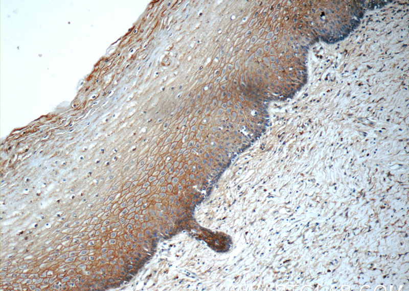 Immunohistochemistry of paraffin-embedded human cervix tissue slide using Catalog No:110984(GJB3 Antibody) at dilution of 1:50 (under 10x lens)