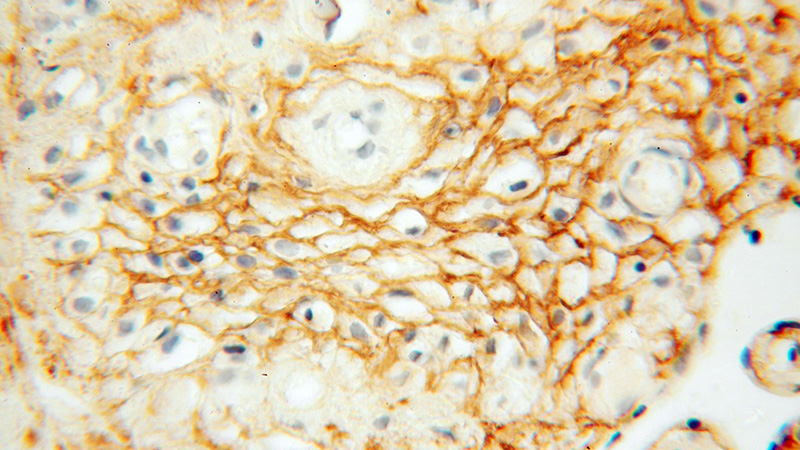 Immunohistochemical of paraffin-embedded human placenta using Catalog No:112526(MFAP5 antibody) at dilution of 1:100 (under 40x lens)