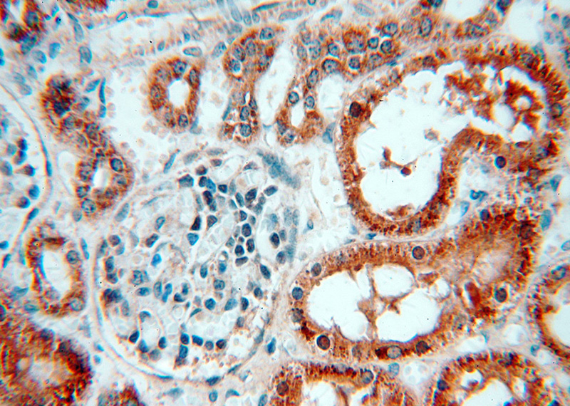 Immunohistochemical of paraffin-embedded human kidney using Catalog No:108876(CASP3 antibody) at dilution of 1:50 (under 40x lens)