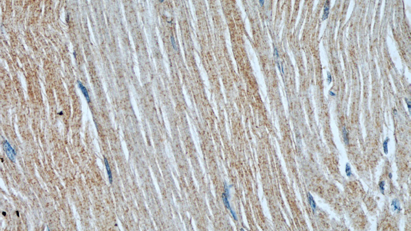 Immunohistochemical of paraffin-embedded human skeletal muscle using Catalog No:107492(RAB27A antibody) at dilution of 1:50 (under 40x lens)