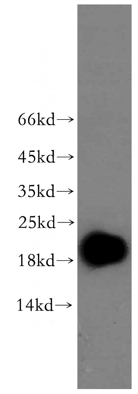 Jurkat cells were subjected to SDS PAGE followed by western blot with Catalog No:110302(EDF1 antibody) at dilution of 1:500