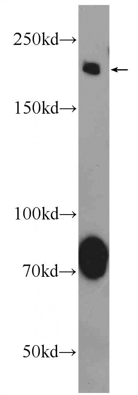 rat brain tissue were subjected to SDS PAGE followed by western blot with Catalog No:107930(AKAP12 Antibody) at dilution of 1:600
