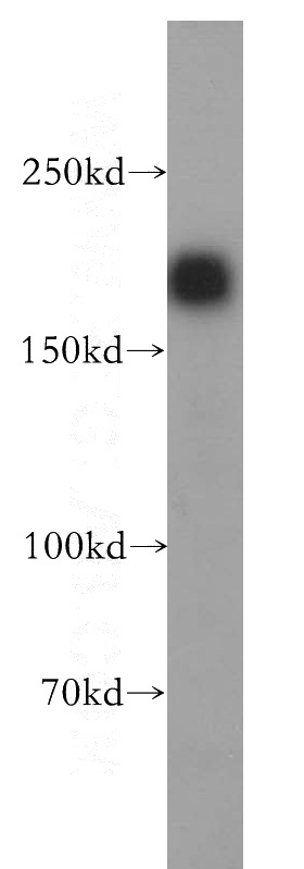 HeLa cells were subjected to SDS PAGE followed by western blot with Catalog No:111295(ERBB2,p185-Specific antibody) at dilution of 1:2000