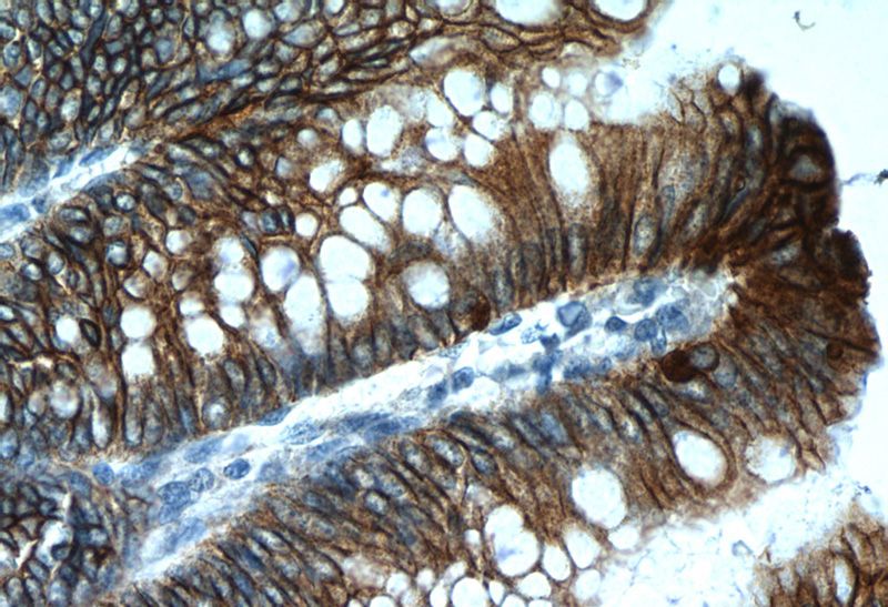 Immunohistochemistry of paraffin-embedded human colon tissue slide using Catalog No:108774(CDH17 Antibody) at dilution of 1:200 (under 40x lens)