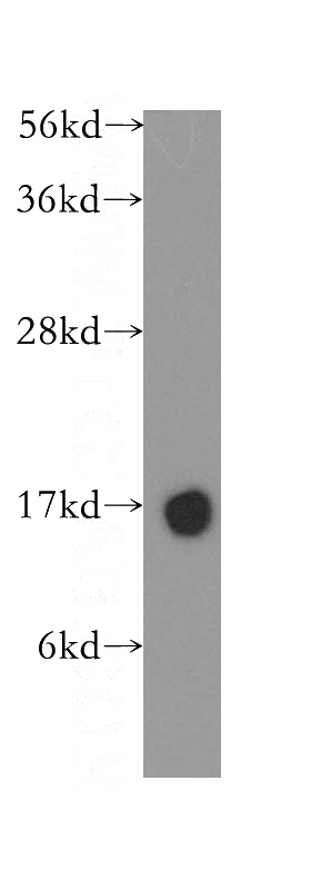human brain tissue were subjected to SDS PAGE followed by western blot with Catalog No:109715(CST3 antibody) at dilution of 1:400