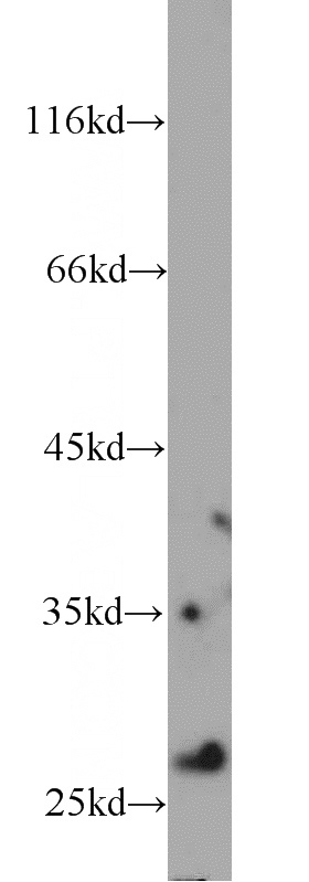 mouse liver tissue were subjected to SDS PAGE followed by western blot with Catalog No:111607(IDI1 antibody) at dilution of 1:300