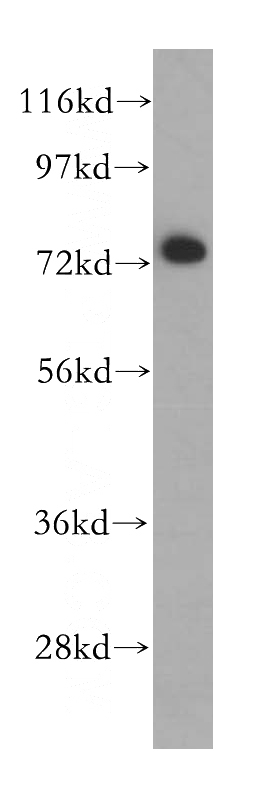 HeLa cells were subjected to SDS PAGE followed by western blot with Catalog No:117229(BRD7 antibody) at dilution of 1:500