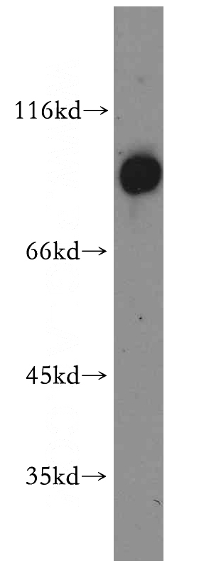 HepG2 cells were subjected to SDS PAGE followed by western blot with Catalog No:108158(ARNT,HIF1B antibody) at dilution of 1:1500