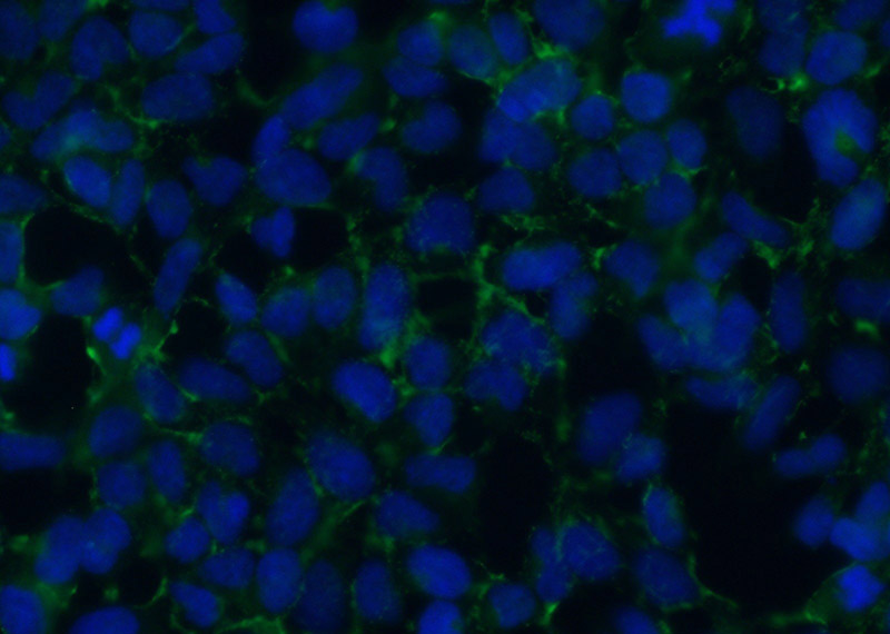 Immunofluorescent analysis of (10% Formaldehyde) fixed HEK-293 cells using Catalog No:115679(STARD3NL Antibody) at dilution of 1:50 and Alexa Fluor 488-congugated AffiniPure Goat Anti-Rabbit IgG(H+L)