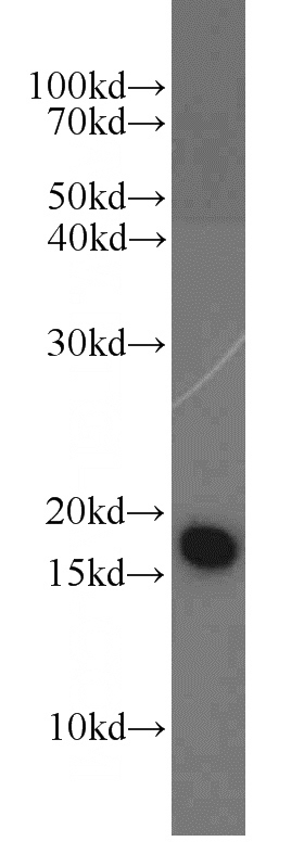 mouse liver tissue were subjected to SDS PAGE followed by western blot with Catalog No:113359(NUDT2 antibody) at dilution of 1:1500