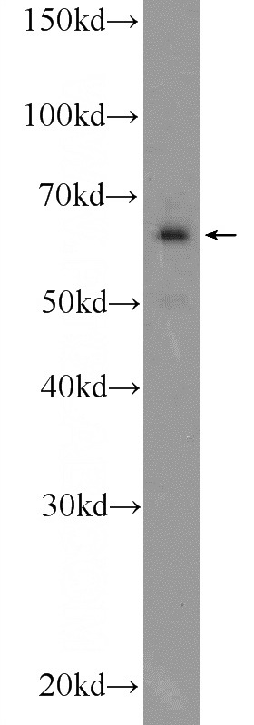 HeLa cells were subjected to SDS PAGE followed by western blot with Catalog No:110422(EYA3 Antibody) at dilution of 1:600