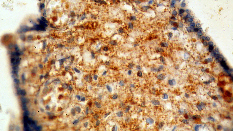 Immunohistochemical of paraffin-embedded human placenta using Catalog No:113015(NAGA antibody) at dilution of 1:100 (under 40x lens)