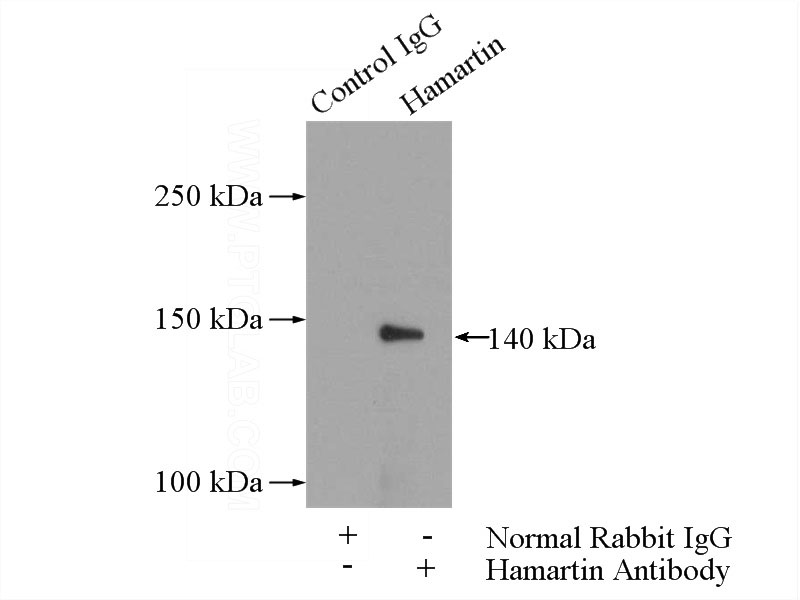 IP Result of anti-hamartin (IP:Catalog No:111335, 4ug; Detection:Catalog No:111335 1:1000) with HeLa cells lysate 2000ug.