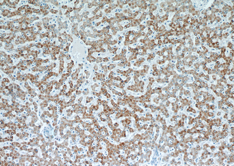 Immunohistochemical of paraffin-embedded human liver using Catalog No:107648(TST antibody) at dilution of 1:50 (under 10x lens)