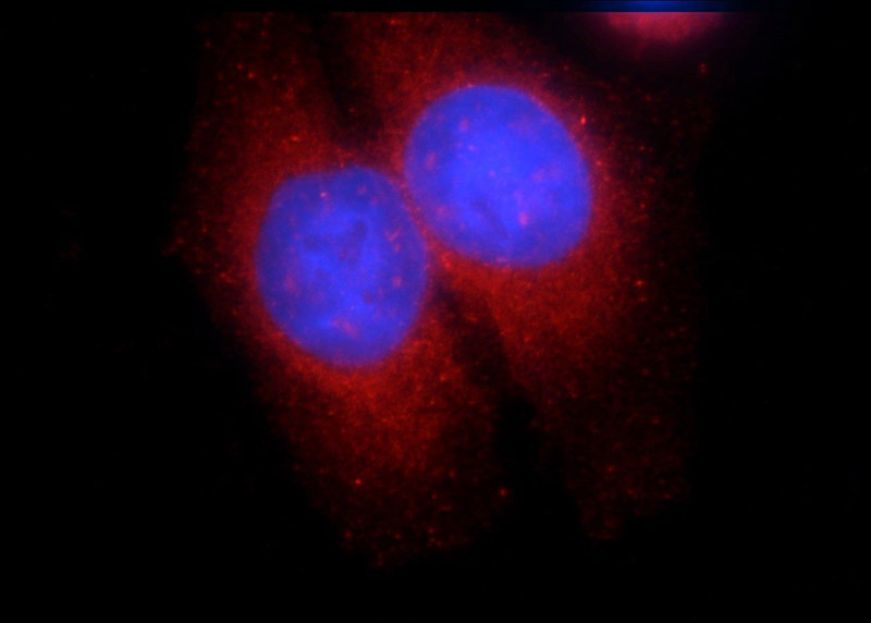 Immunofluorescent analysis of HeLa cells using Catalog No:115486(SNX9 Antibody) at dilution of 1:50 and Rhodamine-Goat anti-Rabbit IgG