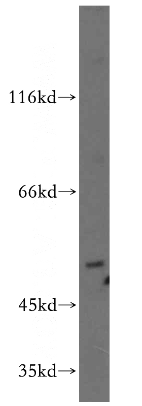 PC-3 cells were subjected to SDS PAGE followed by western blot with Catalog No:110304(LPAR3-Specific antibody) at dilution of 1:500