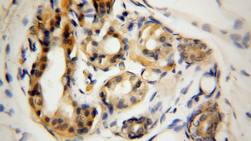 Immunohistochemical of paraffin-embedded human skin using Catalog No:109757(DCT antibody) at dilution of 1:100 (under 40x lens)