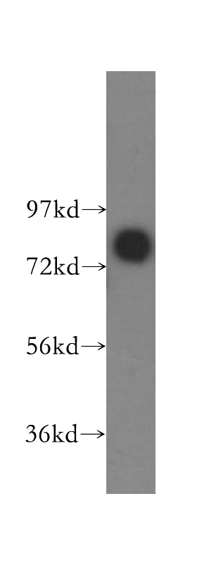 human brain tissue were subjected to SDS PAGE followed by western blot with Catalog No:107801(ABCD1 antibody) at dilution of 1:300