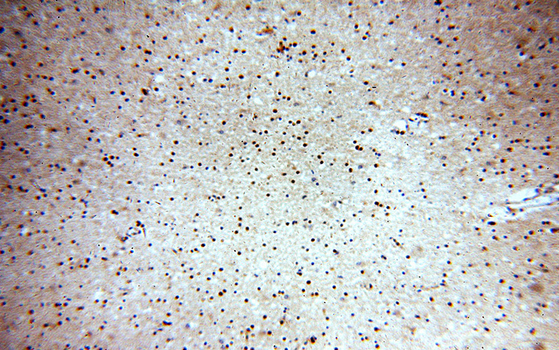 Immunohistochemical of paraffin-embedded human brain using Catalog No:107821(ABT1 antibody) at dilution of 1:100 (under 10x lens)